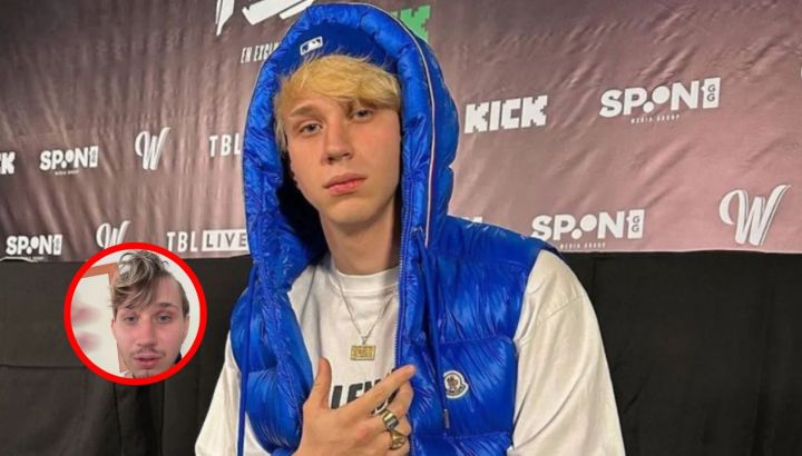 Brunenger mostró cómo quedó su cuerpo tras el trágico accidente: dos meses internado y múltiples cirugías