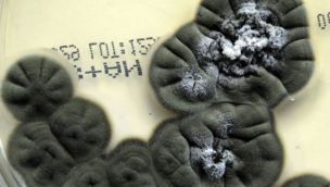 La NASA utilizará “Hongos oscuros” mutados tras Chernobyl como escudos ante la radiación cósmica 0212025