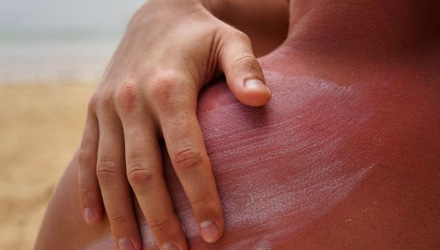 Índice de rayos UV de este 3 de diciembre