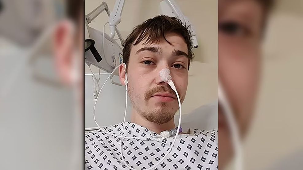 Un hombre de 33 años vomita 60 veces al día.