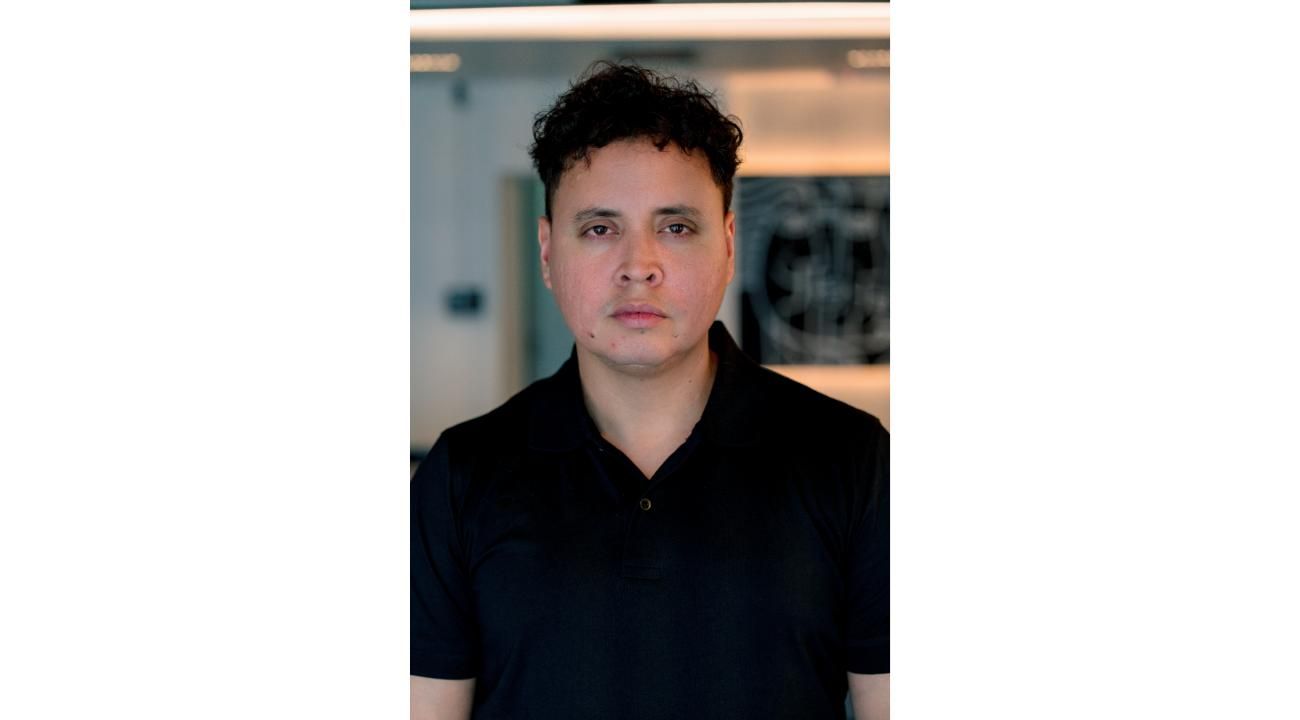 ¿Cuánto dura el relleno del contorno mandibular?