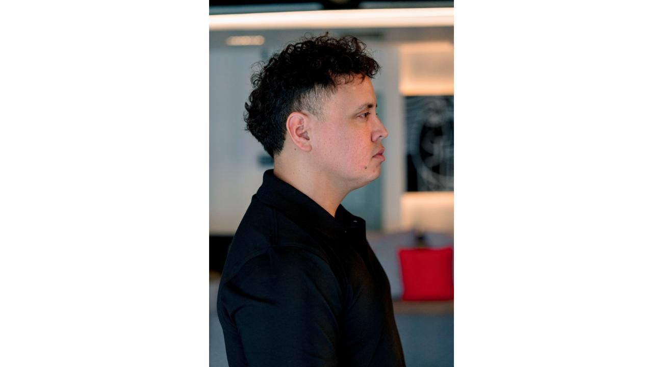 ¿Cuánto dura el relleno del contorno mandibular?