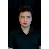 ¿Cuánto dura el relleno del contorno mandibular?