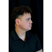 ¿Cuánto dura el relleno del contorno mandibular?