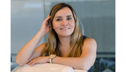 ¿Cuánto dura el relleno del contorno mandibular?