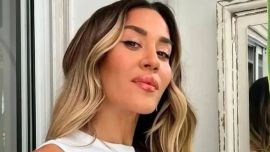 Jimena Barón celebró los dos años "libre de botox" y explicó el motivo por el que dejó de retocarse el rostro