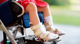 Atrofia Muscular Espinal 09122025