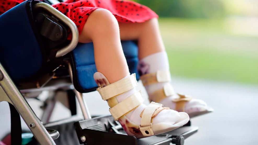 Atrofia Muscular Espinal 09122025