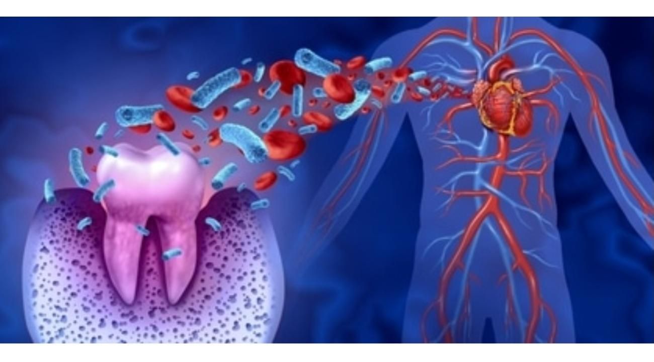 Salud bucal y su relación con Enfermedades Sistémicas