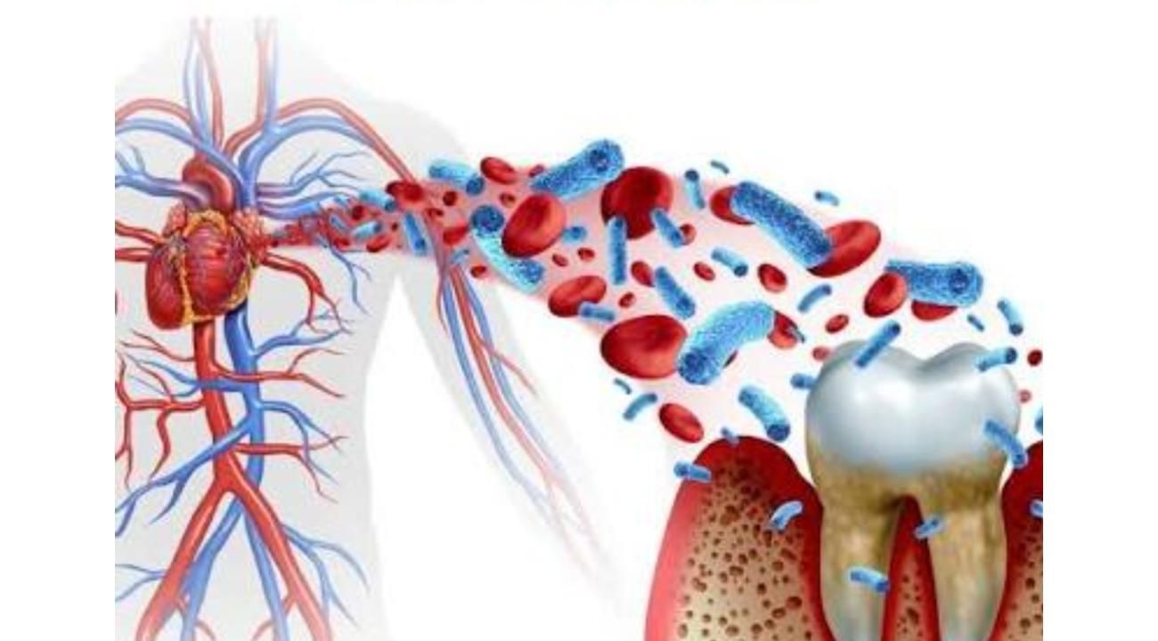 Salud bucal y su relación con Enfermedades Sistémicas