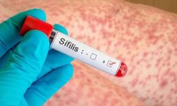 Según el Boletín Epidemiológico Nacional, 