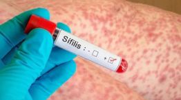 Según el Boletín Epidemiológico Nacional, 