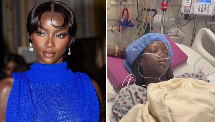 La supermodelo Anok Yai reveló un grave diagnóstico médico que destruye sus pulmones: qué enfermedad tiene