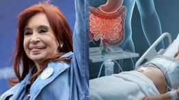 Cristina Kirchner y el íleo posoperatorio 26122025