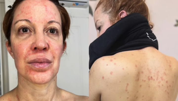 El dramático momento de salud de Miriam Lanzoni: "Noches interminables por dormir envuelta en papel film"