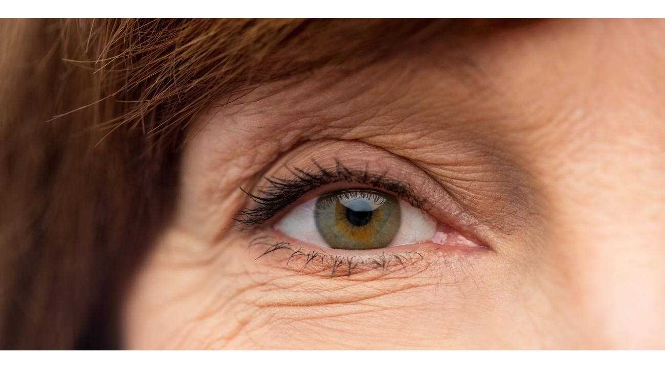 El arte del rejuvenecimiento periorbitario no invasivo