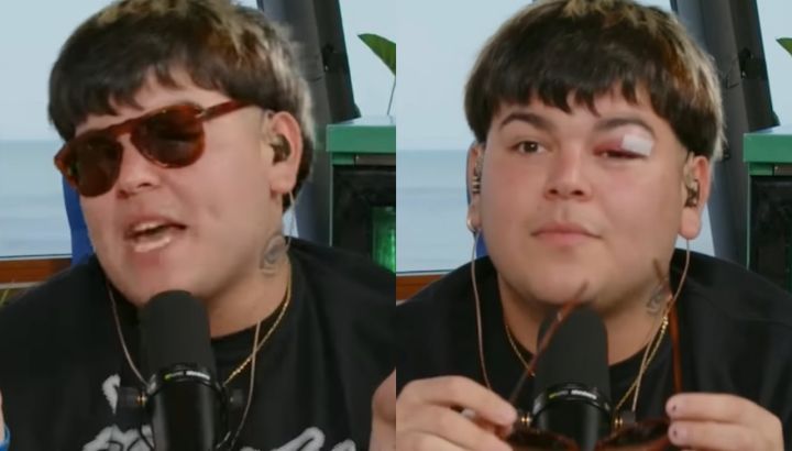 Mortedor sufrió un dramático accidente: se desmayó y se clavó una copa en el ojo