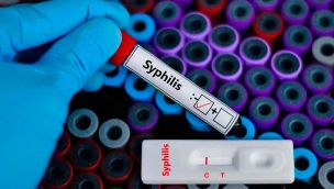 240126_sifilis_cedoc_g