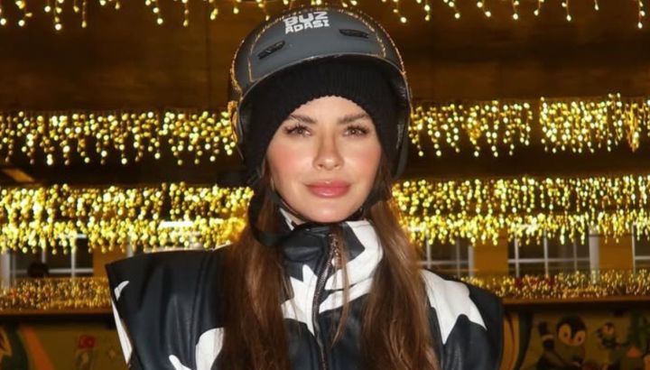 La China Suárez se habría realizado un retoque estético en la cara: la foto que generó polémica