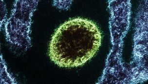 Virus nipah 28012026