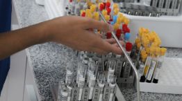 Laboratorio bioquímico
