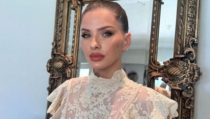 La China Suárez se animó a mostrar el antes y después de su rostro y generó controversias 