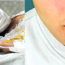 La progresión de la enfermedad tiene consecuencias. Sin tratamiento, la sífilis puede dañar tejidos y órganos vitales. | Foto:Cedoc