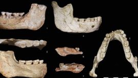 Los investigadores describen a estos individuos como un "mosaico biológico".