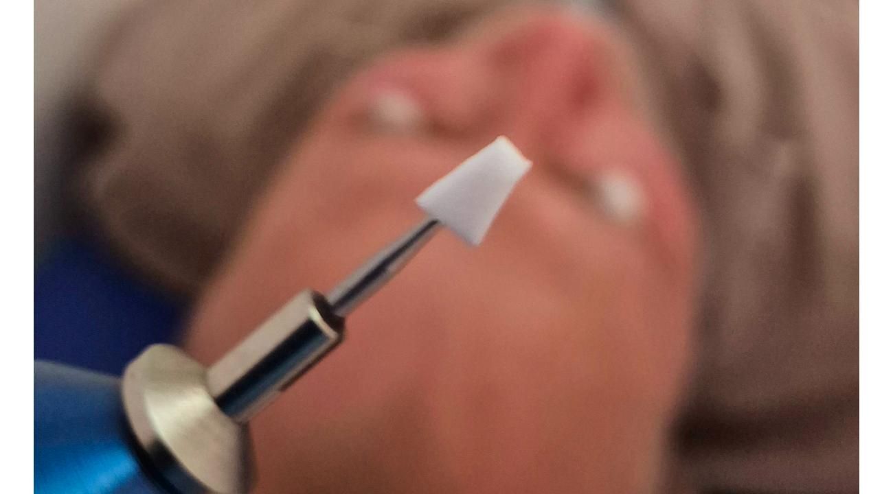 Ojo Seco: el método que cambió el alivio momentáneo por un resultado sostenido