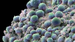 Microplásticos 25022026