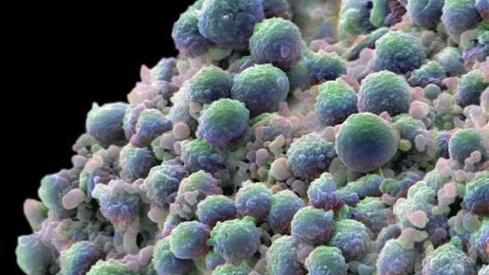 Microplásticos 25022026