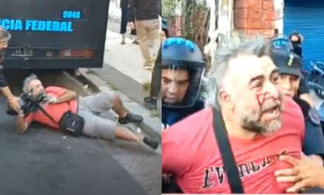 El camarógrafo Facundo Tedeschini fue golpeado y detenido por la Policía Federal en una cobertura en las inmediaciones del Congreso