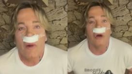 La intervención que se hizo Guido Süller en su rostro: "Le mandé fotos de Val Kilmer"