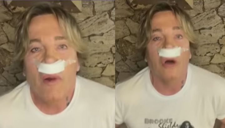 La intervención que se hizo Guido Süller en su rostro: "Le mandé fotos de Val Kilmer"