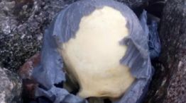 Macabro hallazgo: encuentran un cráneo humano en la playa.