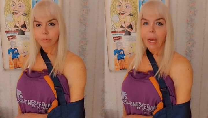 Adriana Aguirre sufrió un accidente en la calle: "Se me salió el hombro para afuera"