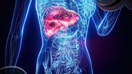 Hígado graso: la enfermedad silenciosa que ya no distingue entre bebedores y no bebedores y crece a ritmo récord