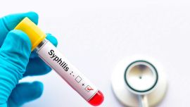 Sífilis: la enfermedad de transmisión sexual que marcó un récord en la Argentina