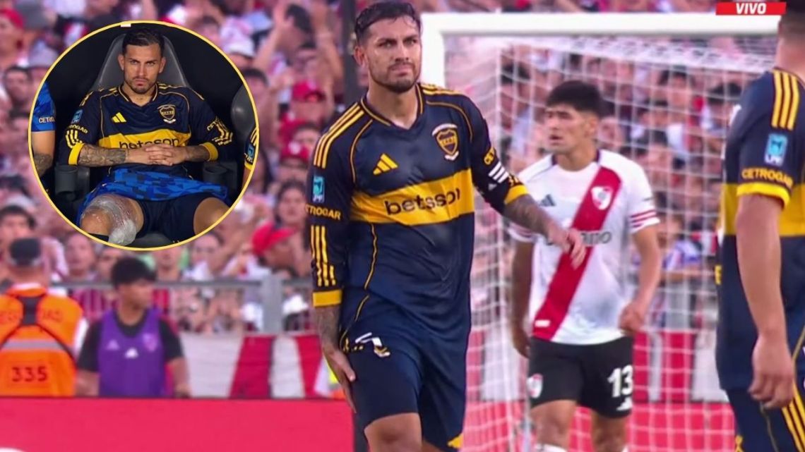 Leandro Paredes salió lesionado del Superclásico y encendió las alarmas en Boca y en la Selección | 442