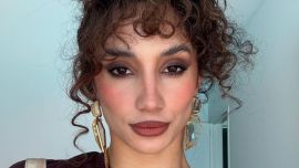 Melody Luz reveló el moretón que tiene en su cuerpo: "Cómo lo explico"