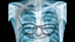 250426_rayos_x_milei_temes_g