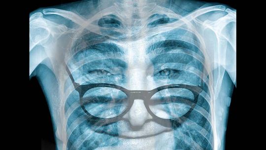 La pobreza: su medición, sus causas y cómo reducirla