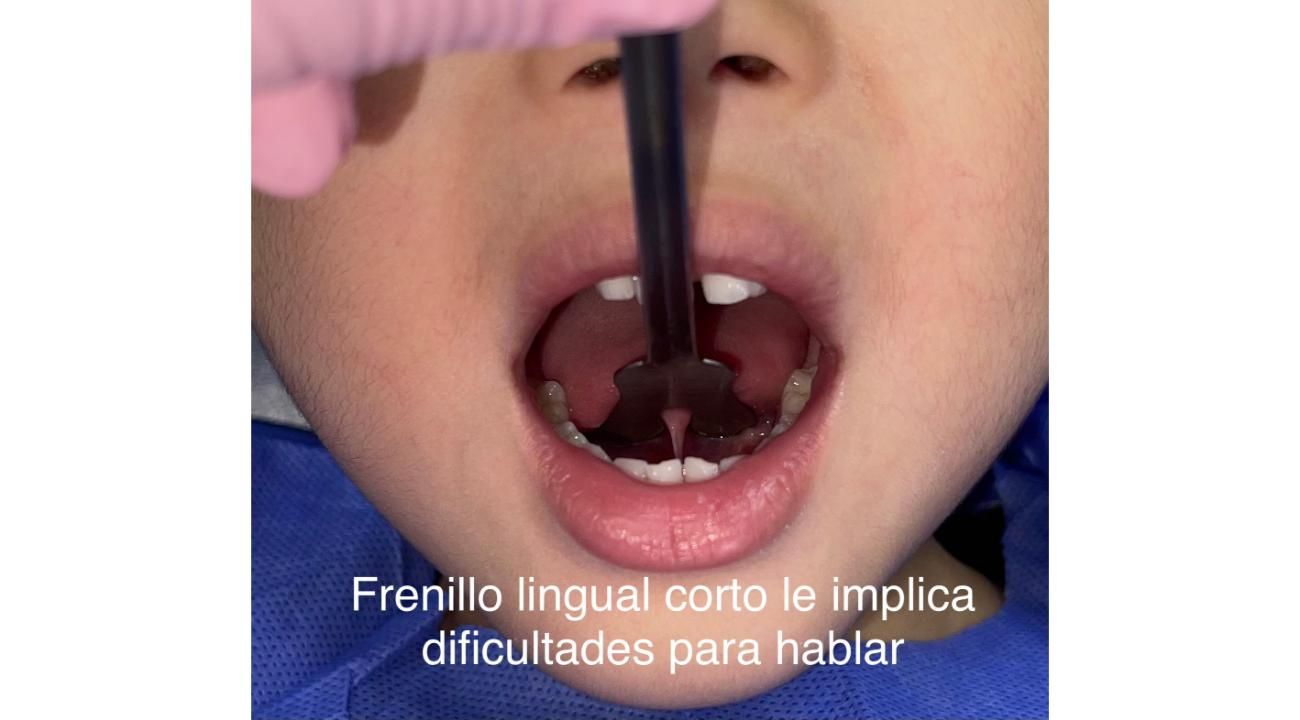 Título:” Los 1.000 días de oro”