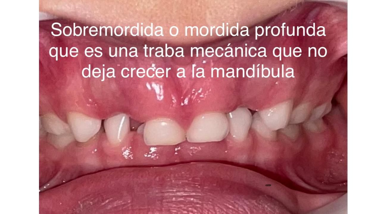 Título:” Los 1.000 días de oro”