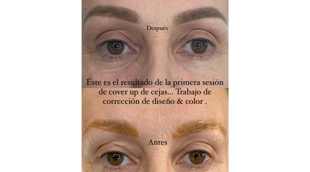 EL AUGE DE LA CORRECCIÓN DE CEJAS: ERRORES COMUNES, SOLUCIONES REALES