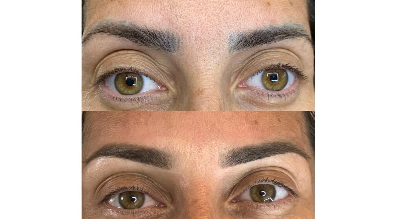 EL AUGE DE LA CORRECCIÓN DE CEJAS: ERRORES COMUNES, SOLUCIONES REALES