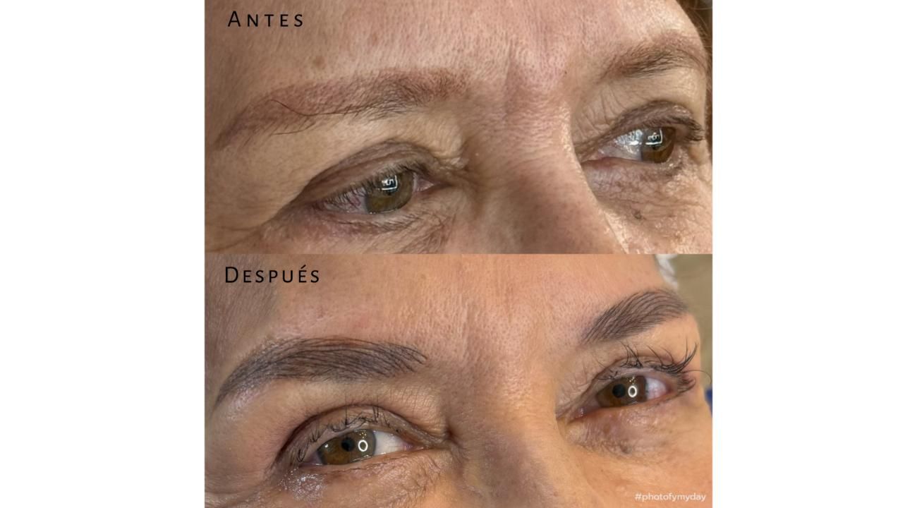 EL AUGE DE LA CORRECCIÓN DE CEJAS: ERRORES COMUNES, SOLUCIONES REALES