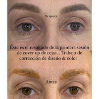 EL AUGE DE LA CORRECCIÓN DE CEJAS: ERRORES COMUNES, SOLUCIONES REALES