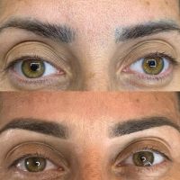 EL AUGE DE LA CORRECCIÓN DE CEJAS: ERRORES COMUNES, SOLUCIONES REALES