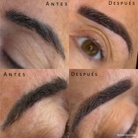 EL AUGE DE LA CORRECCIÓN DE CEJAS: ERRORES COMUNES, SOLUCIONES REALES